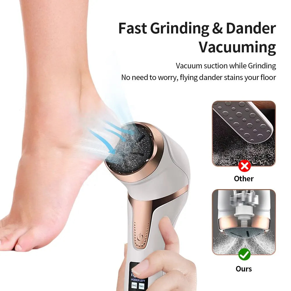 Portable Foot Callus Remover Rechargeable